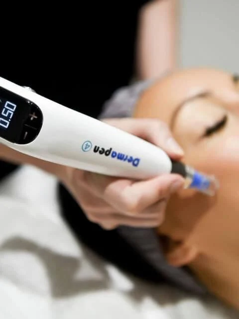 Dermapen-4 ph-14 Dermapen-4 ph-14